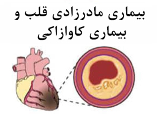 بیماری مادرزادی قلب و بیماری کاوازاکی 